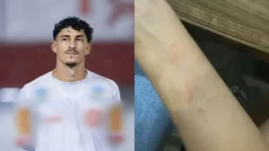 Jogador do Rio Verde é preso suspeito de agredir namorada durante festa